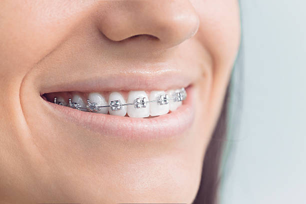 Best Veneers and Lumineers  in Ellaville, GA